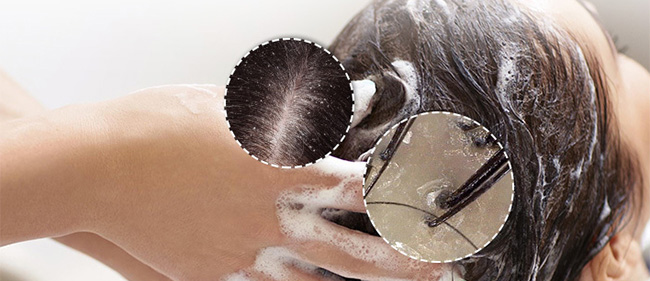Косметические серии / Lador - Ладор эффективная косметика для волос, лица и тела из Кореи / Уход за кожей головы Ладор Lador Scalp Care